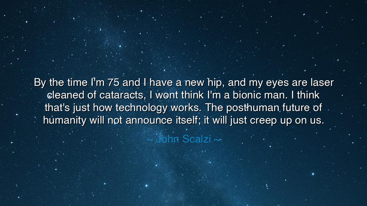 By the time I'm 75 and I have a new hip, and my eyes are laser