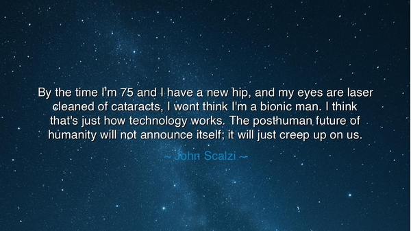 By the time I'm 75 and I have a new hip, and my eyes are laser